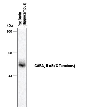 Detection of GABAAR a5 C-Terminus antibody by Western Blot.
