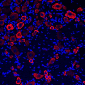 GABABR1 antibody in Rat Brain by Immunohistochemistry (IHC-Fr).