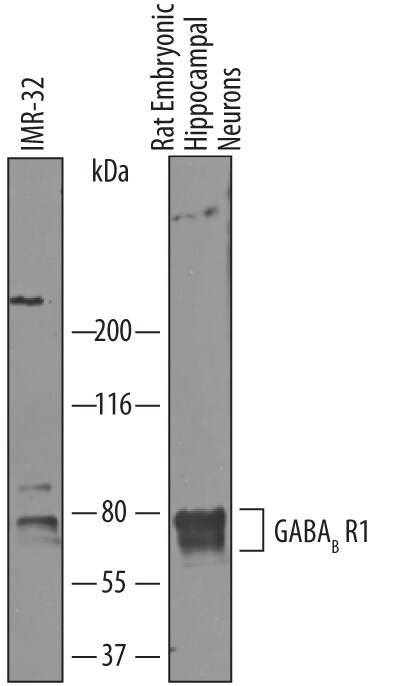 Detection of Human and Rat GABABR1 antibody by Western Blot.