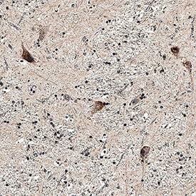 GABABR2 antibody in Human Brain by Immunohistochemistry (IHC-P).