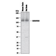 Detection of Mouse and Rat GABABR2 antibody by Western Blot.