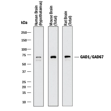 Detection of Human, Mouse, and Rat GAD1/GAD67 antibody by Western Blot.