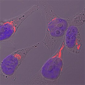 Polypeptide GalNac Transferase 2/GALNT2 antibody in HeLa Human Cell Line by Immunocytochemistry (ICC).