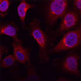 Polypeptide GalNac Transferase 3/GALNT3 antibody in HeLa Human Cell Line by Immunocytochemistry (ICC).