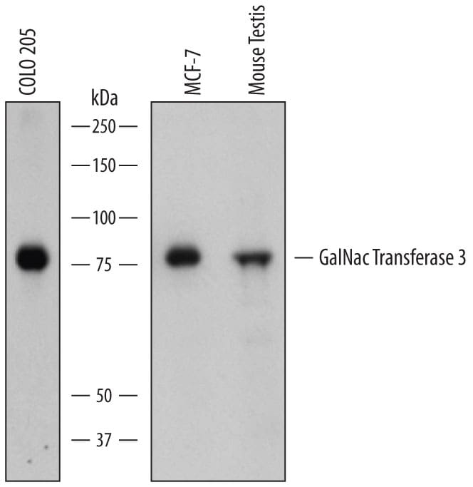 Detection of Human and Mouse Polypeptide GalNac Transferase 3/GALNT3 antibody by Western Blot.