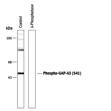 Detection of Phospho-GAP-43 (S41) antibody by Western Blot.