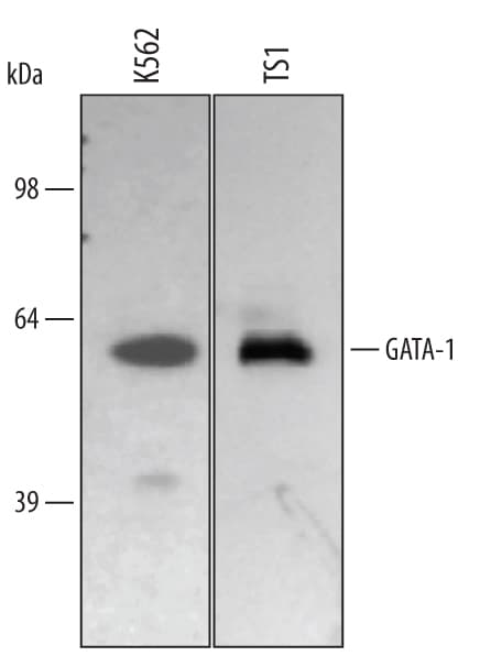 Detection of Human GATA‑1 antibody by Western Blot.