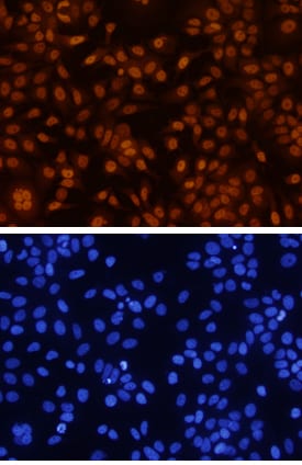 GATA‑3 antibody in MCF-7 Human Cell Line by Immunocytochemistry (ICC).