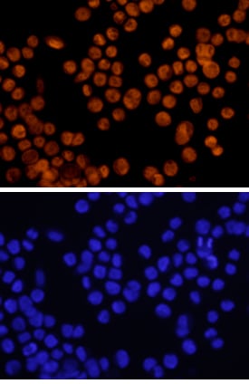 GATA‑6 antibody in KATO-III Human Cell Line by Immunocytochemistry (ICC).