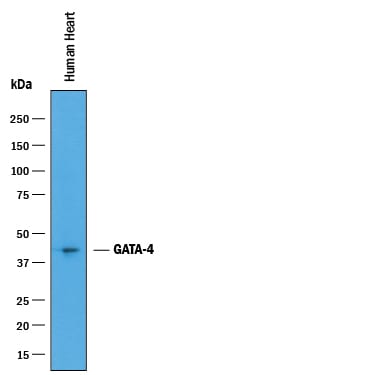 Detection of Human GATA‑4 antibody by Western Blot.