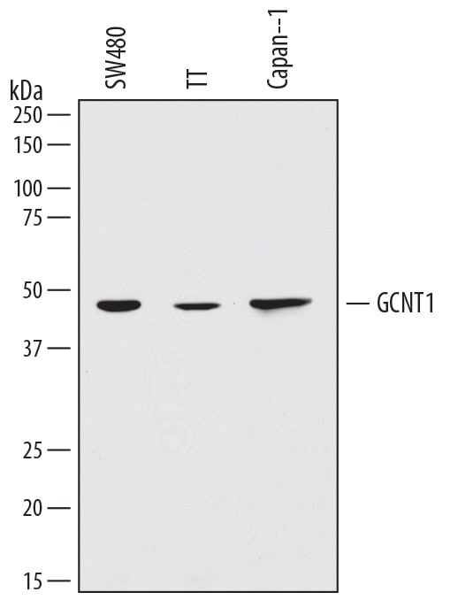 Detection of Human Glucosaminyl (N-acetyl) Transferase 1/GCNT1 antibody by Western Blot.