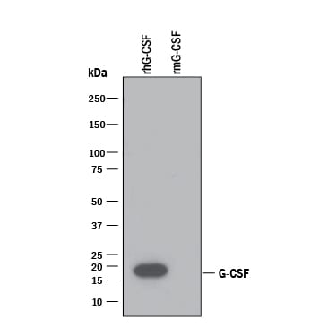 Detection of Recombinant Human G-CSF antibody by Western Blot.