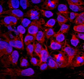 GDF-3 antibody in BG01V Human Stem Cells by Immunocytochemistry (ICC).