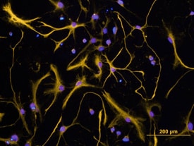 GFAP antibody in Rat Cortical Stem Cells by Immunocytochemistry (ICC).
