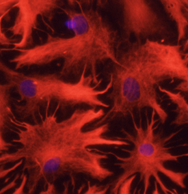 GFAP antibody in Rat Astrocytes by Immunocytochemistry (ICC).