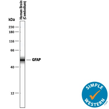 Detection of Human GFAP antibody by Simple WesternTM.