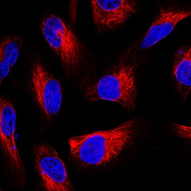 GFAP antibody in U-251MG Human Cell Line by Immunocytochemistry (ICC).