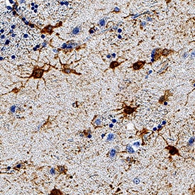 GFAP antibody in Human Brain by Immunohistochemistry (IHC-P).
