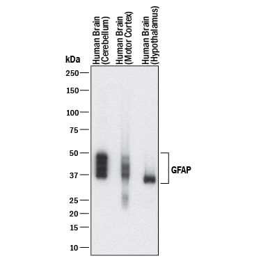 Detection of Human GFAP antibody by Western Blot.