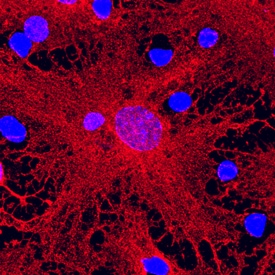 GFAP antibody in Rat Cortical Stem Cells by Immunocytochemistry (ICC).