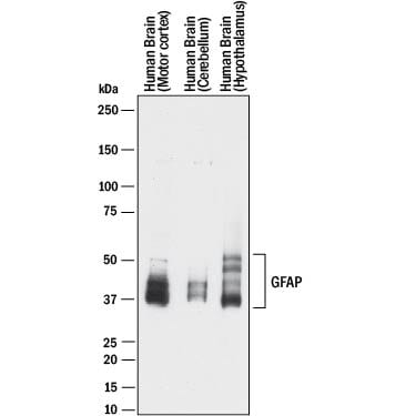 Detection of Human GFAP antibody by Western Blot.