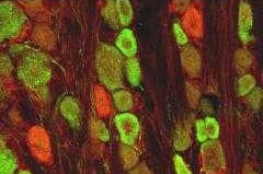 GDNF and GFRa‑1 antibody in Rat Dorsal Root Ganglia by Immunohistochemistry (IHC-Fr).