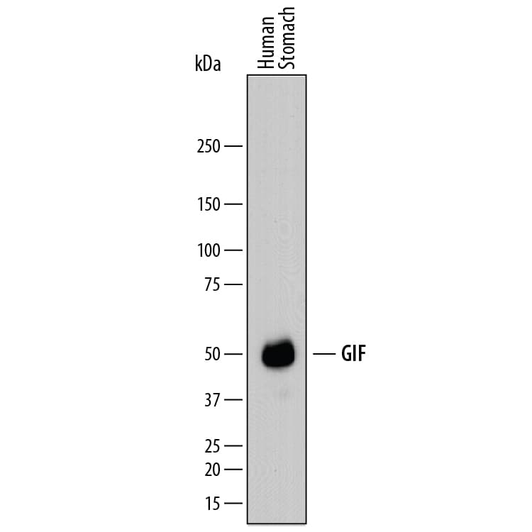 Detection of Human GIF antibody by Western Blot.