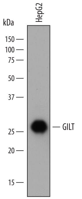 Detection of Human GILT/IFI30 antibody by Western Blot.