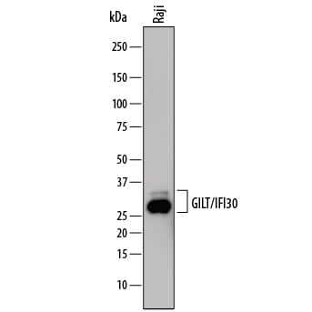 Detection of Human GILT/IFI30 antibody by Western Blot.
