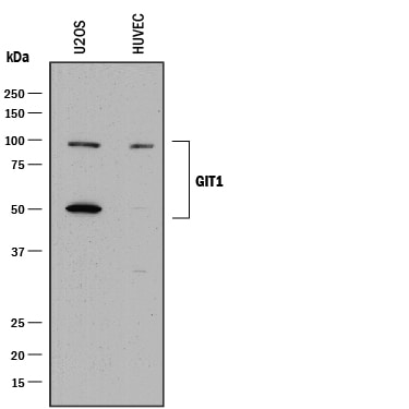 Detection of Human GIT1 antibody by Western Blot.