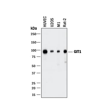 Detection of Human, Mouse, and Rat GIT1 antibody by Western Blot.