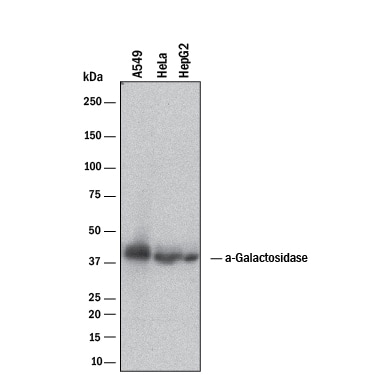 Detection of Human a-Galactosidase A/GLA antibody by Western Blot.