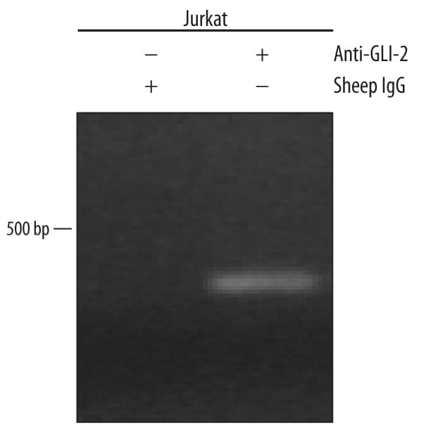 Detection of GLI-2-regulated Genes antibody by Chromatin Immunoprecipitation.