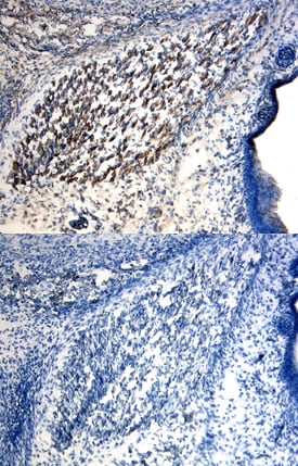 GLI-2 antibody in Mouse Embryo by Immunohistochemistry (IHC-Fr).