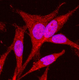 GLI-2 antibody in MDA-MB-231 Human Cell Line by Immunocytochemistry (ICC).