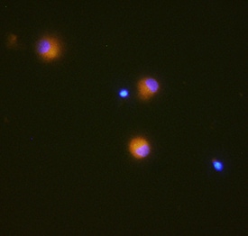 GM-CSF antibody in Human Dendritic Cells by Immunocytochemistry (ICC).