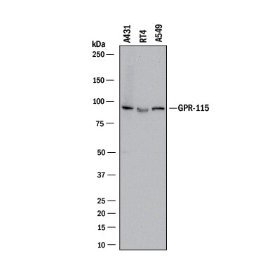 Detection of Human GPR115 antibody by Western Blot.