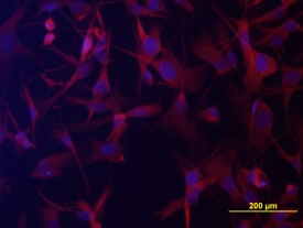 GPR34 antibody in A172 Human Cell Line by Immunocytochemistry (ICC).