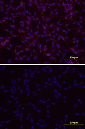 GPR50 antibody in A172 Human Cell Line by Immunocytochemistry (ICC).