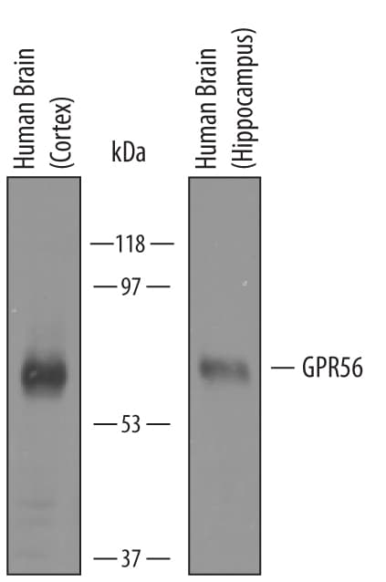 Detection of Human GPR56 antibody by Western Blot.