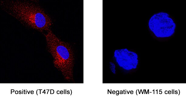 GPR56 antibody in T47D human breast cancer cell line by Immunocytochemistry (ICC).