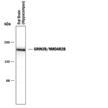 Detection of GRIN2B/NMDAR2B antibody by Western Blot