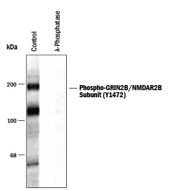 Detection of Phospho-GRIN2B/NMDAR2B (Y1472) antibody by Western Blot