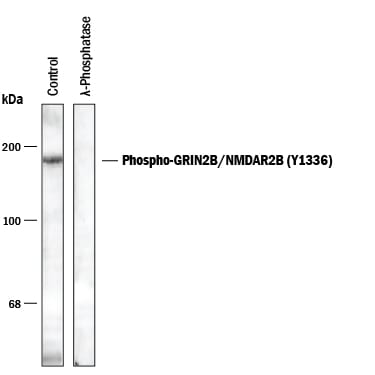 Detects Phospho-GRIN2B/NMDAR2B (Y1336) by Western Blot.