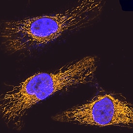 GRP75/HSPA9B antibody in HeLa Human Cell Line by Immunocytochemistry (ICC).