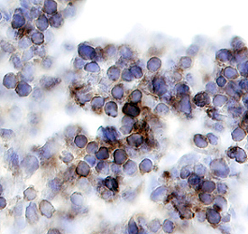 GSK‑3a antibody in Human Thymus by Immunohistochemistry (IHC-P).