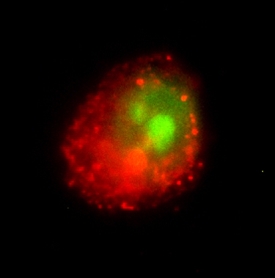 GSK‑3 beta  antibody in MCF-7 Human Cell Line by Immunocytochemistry (ICC).