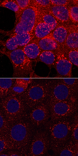 Phospho-GSK-3 beta  (S9) antibody in MCF-7 Human Cell Line by Immunocytochemistry (ICC).