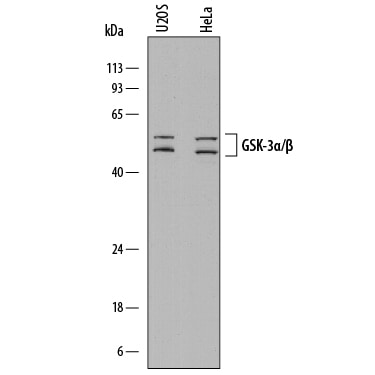 Detection of Human GSK 3a and GSK-3 beta  antibody by Western Blot.