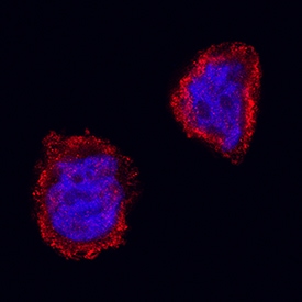 GSK-3 beta  antibody in HT-29 Human Cell Line by Immunocytochemistry (ICC).